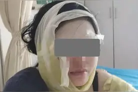 疑因揽客抢生意大排档一家三口被热油烫伤妻子半边脸毁容，警方调监控调查，先以救治为主，谁烫谁暂不下结论图片