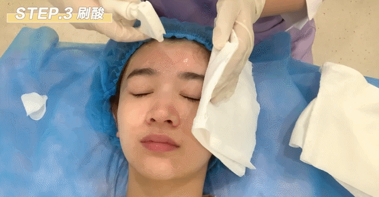 网上超火的刷酸护肤,真的会烂脸吗?