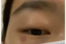 关灯玩手机，引来一只虫子，美女说“差点毁容”图片