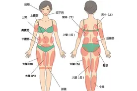 吸脂是不是就是减肥？吸完就一劳永逸了吗？图片