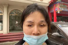 周口24岁女子花1.2万整鼻子，不料鼻子越来越大还发臭图片