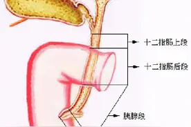 「胆胰管解剖」胆管解剖、变异及先天性胆管扩张症图片
