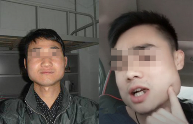 槟榔之殇：成瘾只是表象，6000万人的爱好，如何成割脸的诱因