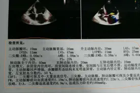 检查心脏，心电图、心脏彩超哪个更准确？看看医生怎么说图片