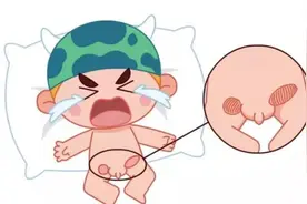 小儿疝气手术，做了24小时就可出院？图片