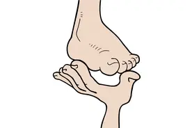 脚上长水疱脱皮，还很痒怎么办？图片