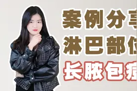 为什么淋巴部位会长痘痘，淋巴部位长痘痘怎么办？视频封面