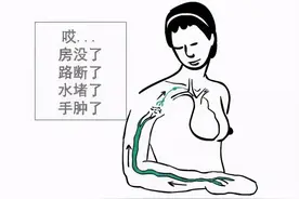 「安军明教授谈预防、治疗淋巴水肿」如何消除“大象腿”图片