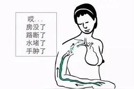 「安军明教授谈预防、治疗淋巴水肿」如何消除“大象腿”图片