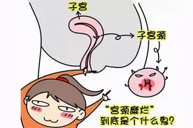 宫颈糜烂不用治？宫颈糜烂能自行恢复吗？医生辟谣来了图片