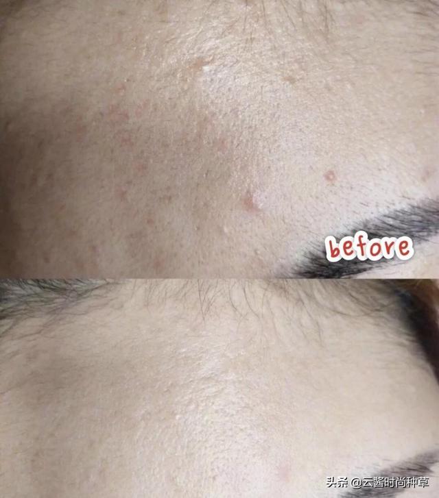 隆力奇可不可以当身体乳