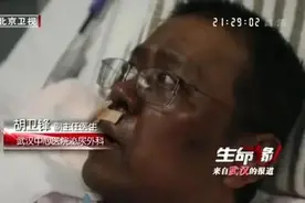 武汉医生感染被救后先变黑，再出血！新冠病毒没你想那样简单图片