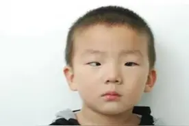 6岁男孩黑眼球逐渐消失，“凶手”是每天都会用到的“玩具”图片