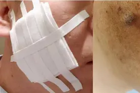 东方快评丨用烟头烫下属被拘，莫让欺凌文化成为就业阴影图片