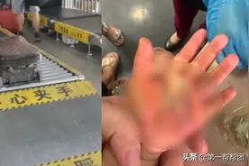 火车站过安检，母亲一不留神，女儿的手被扯下一层皮图片