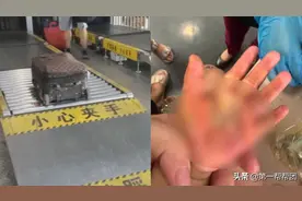 火车站过安检，母亲一不留神，女儿的手被扯下一层皮图片