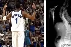 麦迪、纳什、姚明、哈登，盘点身体有缺陷却成为巨星的NBA球员图片