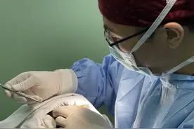 明天是爱发日，你秃了吗？围观植发全过程，还有人把腿毛当眉毛用图片