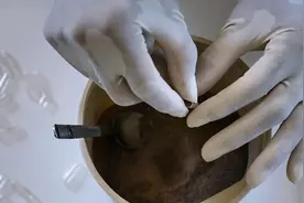 产后胎盘如何处理？带回家还是留在医院？结果各有不同图片