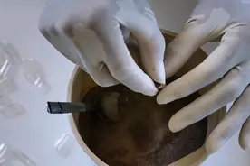 产后胎盘如何处理？带回家还是留在医院？结果各有不同图片
