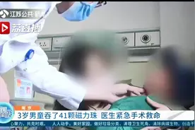 祸从口入！3岁男童吞了41颗磁力珠 医生紧急手术救命图片