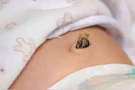 肚脐眼里抠出臭臭的“黑泥”，到底是啥？真实答案有点重口味图片