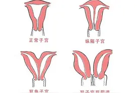她的子宫跟别人不一样，别人一个她一半，直接影响受孕几率图片