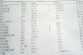 「攻略」肝脏体检单31个单项逐一解读图片