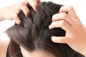 痒痒痒！头皮长红色的小疙瘩，该咋办？图片