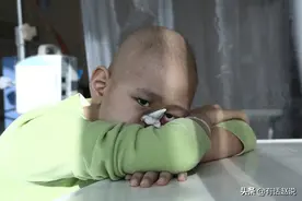 男童遭病菌吃掉鼻子，父母要为他安装漂亮鼻子时，旧病复发图片