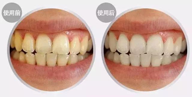 涓€娆惧彿绉?鈥滀笂甯濆垱閫犵殑鐗欒啅鈥?姊呭ゥ鍖婚櫌閮芥槸鎸囧畾瀹?缃戝弸锛氫竾鑳? onerror=