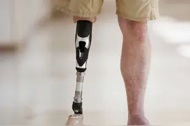 医生札记：那条我花了七个月保住的腿，最终还是截掉了图片