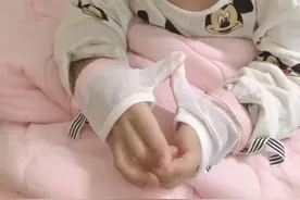 分享宝宝如何戒掉吮手指这个坏习惯图片