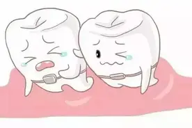 为什么你的托槽总是掉图片