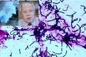 疯狂科学家为获永生，大胆注射350万年前猛犸象细菌，结果怎样了图片