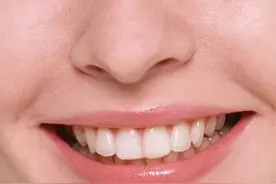 什么颜色的牙齿最健康图片