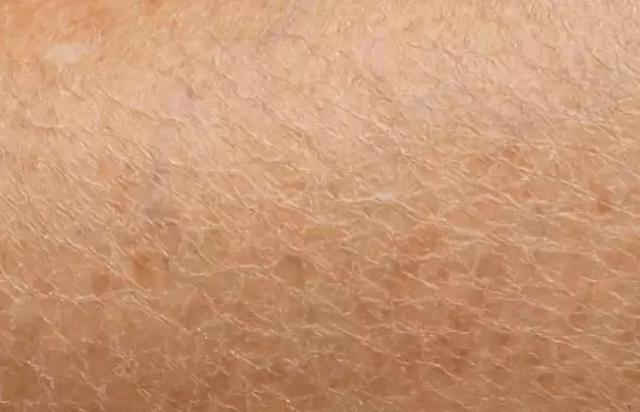 小黑裙身体乳长期涂抹能美白吗