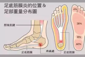 产后脚后跟疼的原因在这里，两个方法帮你改善图片
