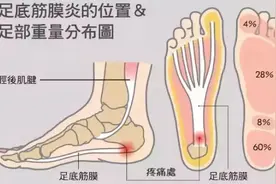 产后脚后跟疼的原因在这里，两个方法帮你改善图片