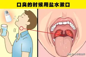 在遇到麻烦的情况下，能够帮到你的10个日常用品图片