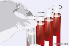 “骨髓”捐献是抽骨髓吗？图片