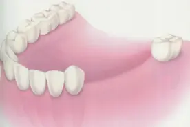 都在问现在的种植牙技术成熟吗？看看就知道图片