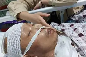 福建男子意外摔倒住进ICU，漂亮女儿日夜守护：我不能失去父亲图片