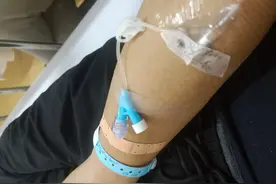 打留置针，让实习生白戳了一针图片