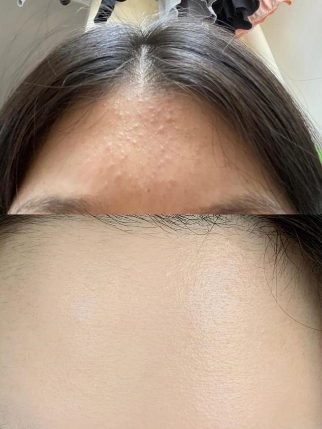濡備綍鍘昏劯涓婄殑闂彛锛熶釜浜烘垚鍔熺粡鍘嗗垎浜? onerror=