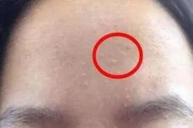 床单久睡不晒螨虫“成堆”？教你1招，不用洗不用晒，轻松除螨虫图片