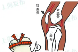 【医聊】越跑越疼？听膝盖说说怎样让跑步不受伤~图片