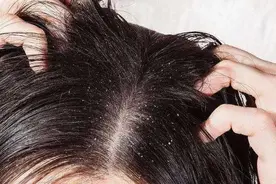 不去理发店，靠洗发水就可蓬松头发，“油头”女孩：真能3天不洗图片