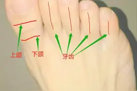 受风寒腿疼图片