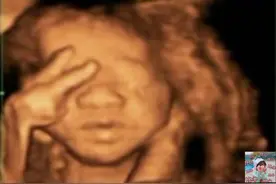 准妈妈做四维彩超，发现胎儿在腹中“数数”，医生：未来数学天才图片